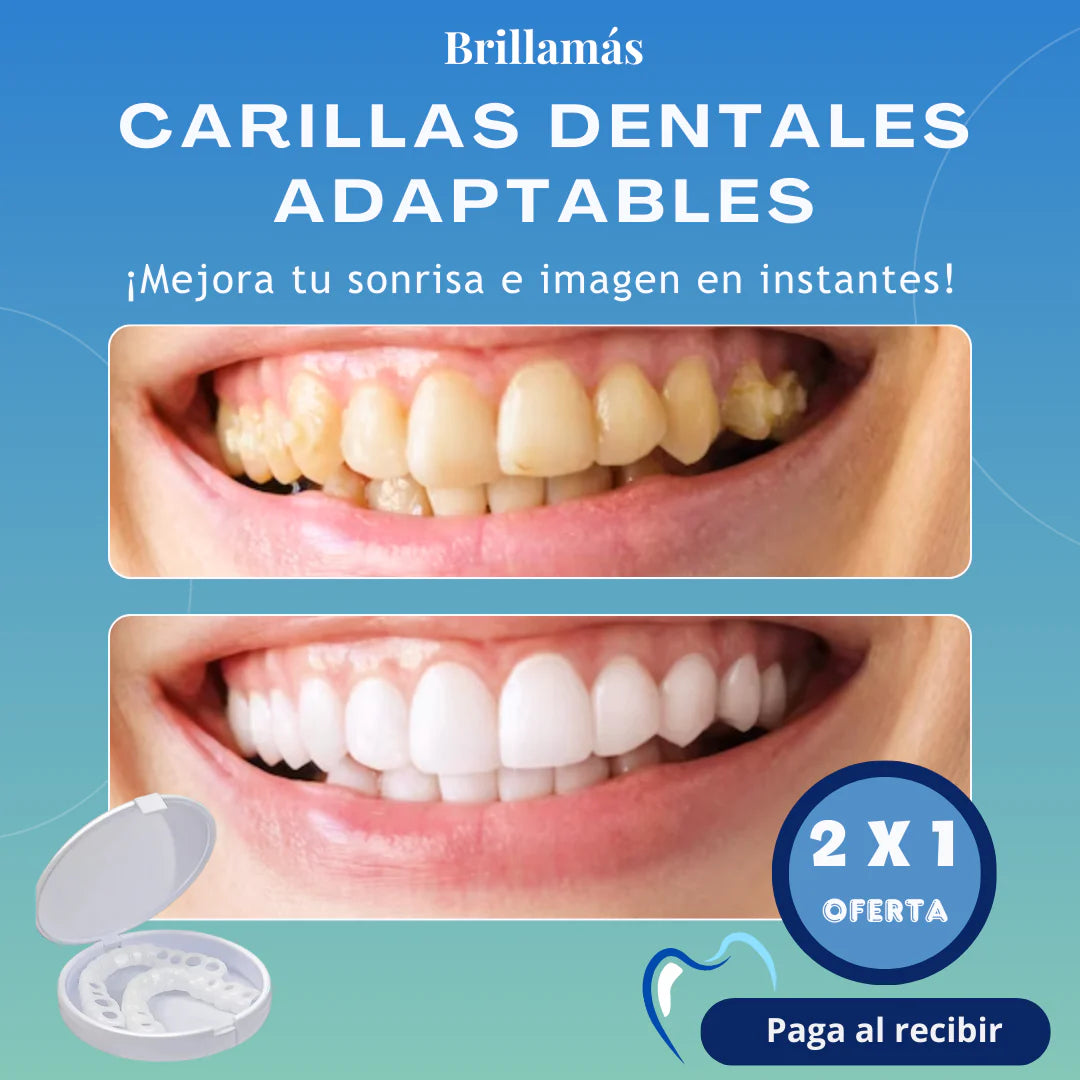 Snapon Smile® - Carillas Dentales